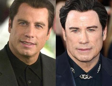 john travolta face lift|John Travolta Before and After Plastic Surgery